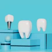 3D render of two white teeth and a dental implant model displayed on blue geometric platforms against a blue background.